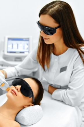 Laser hair removal face