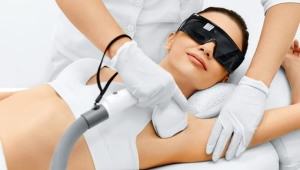 Laser hair removal