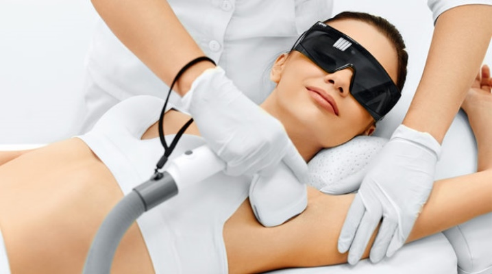 Laser hair removal